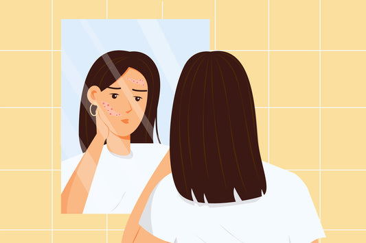 The Ultimate Guide to Treating Facial Eczema