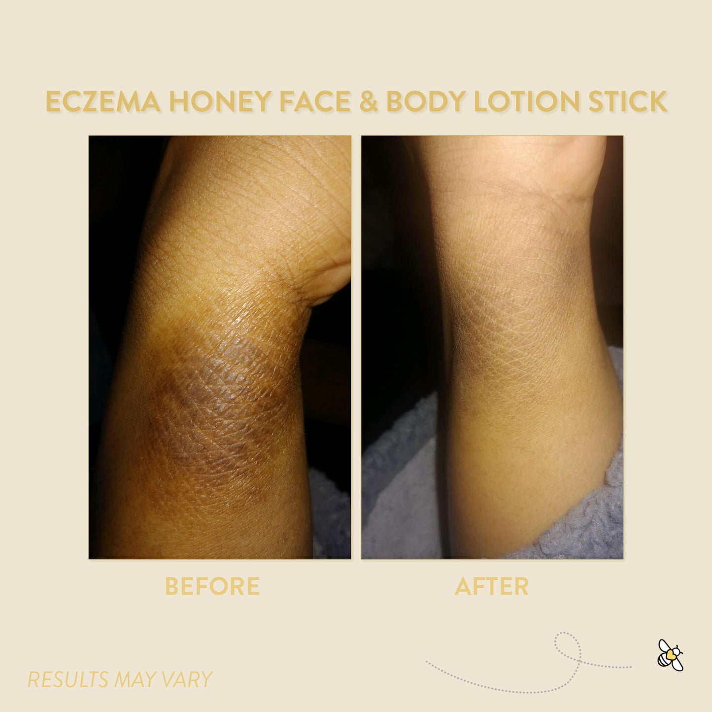 Eczema Honey Gentle Face and Body Lotion Stick