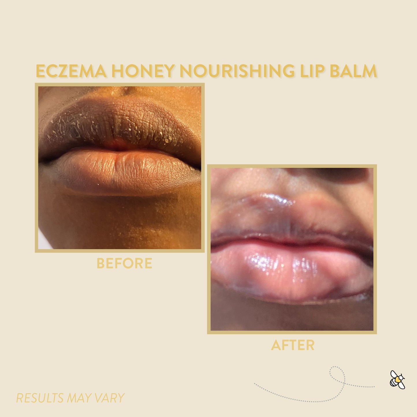 Eczema Honey Nourishing Lip Balm