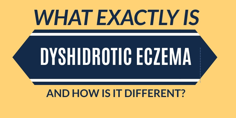 What Exactly Is Dyshidrotic Eczema and How is it Different?