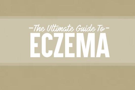 The Ultimate Guide to Eczema