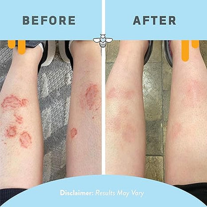 Psoriasis Honey Skin-Renewing Cream