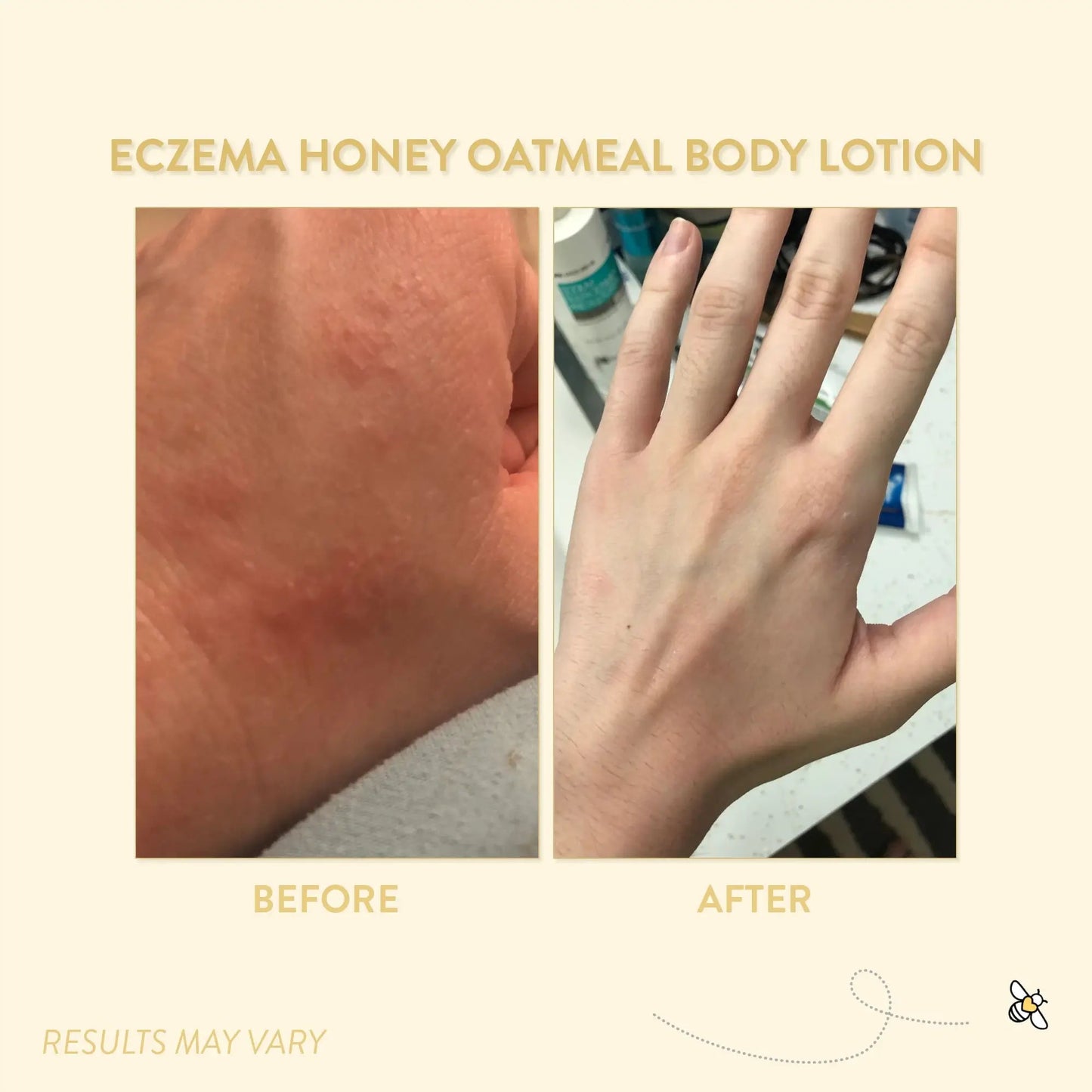Eczema Honey Oatmeal Body Lotion 0.5 oz