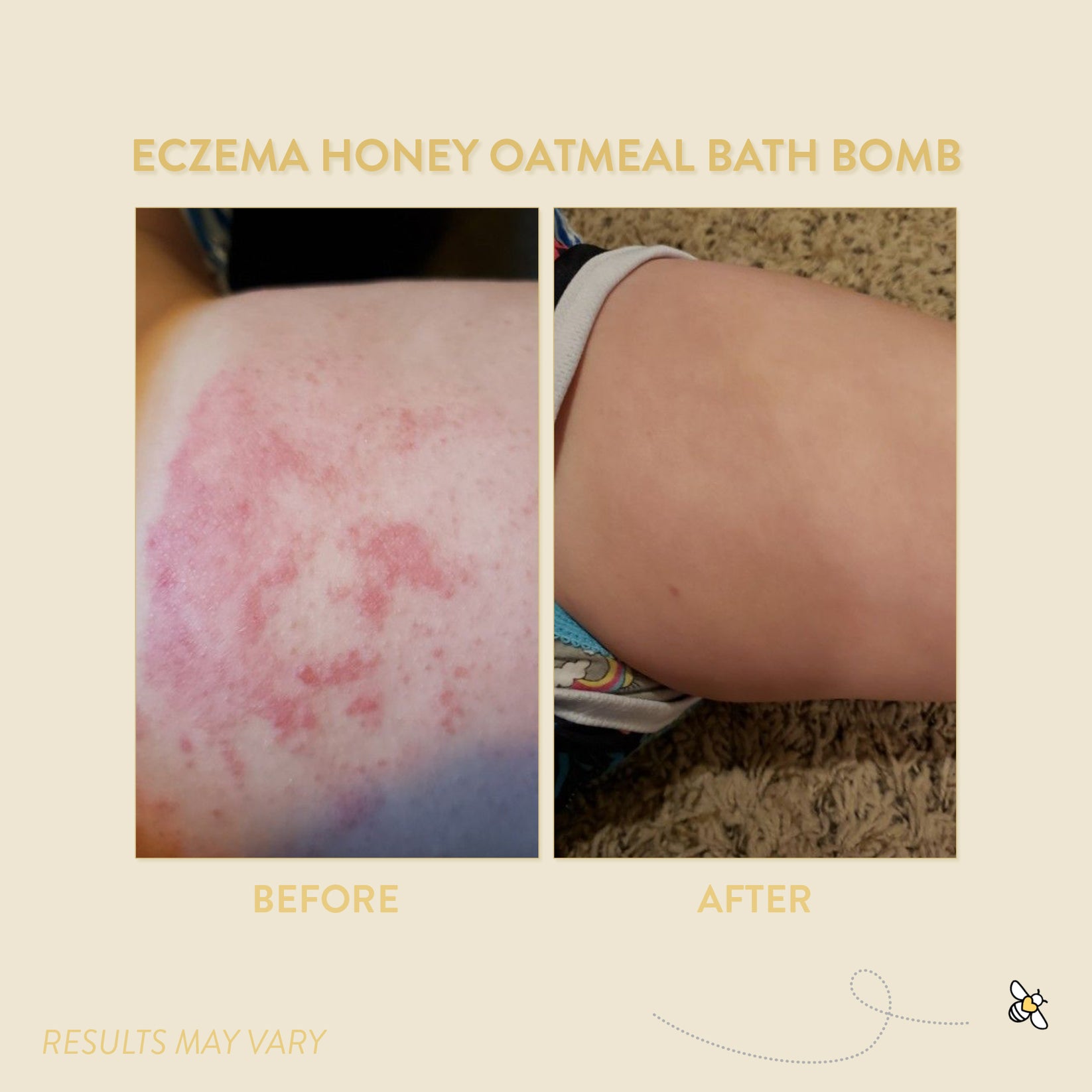 Eczema Honey Oatmeal Bath Bomb Eczema Honey Co