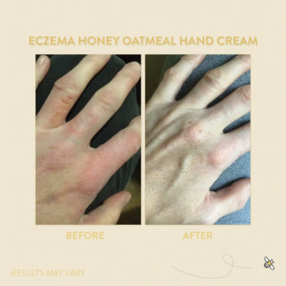 Eczema Honey Oatmeal Hand Cream 2 oz