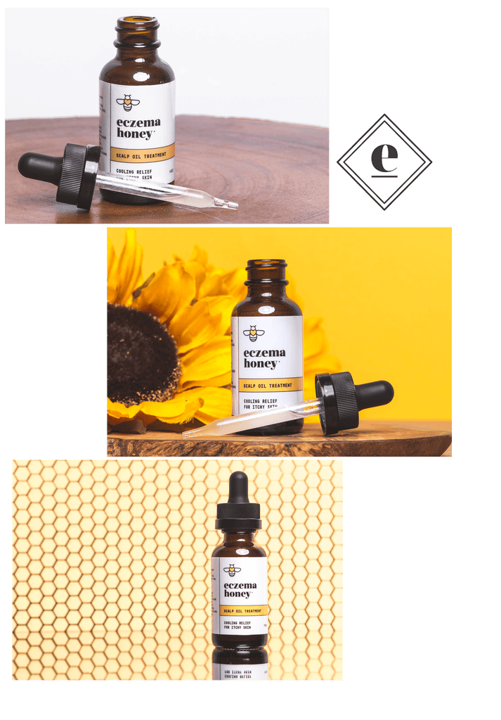 Eczema Honey Soothing Scalp Oil Eczema Honey Co